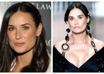 Когда с пластикой перестарались: 30 знаменитостей “До и после”